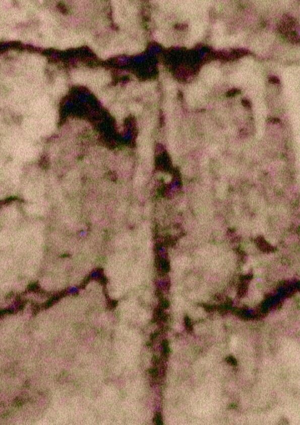 Ruido; Rauca